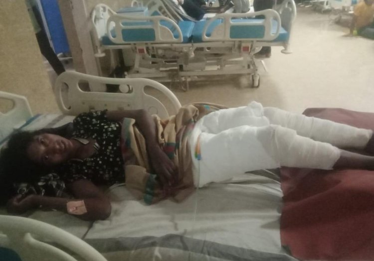 CM साय की संवेदनशीलता से आग से झुलसी सुकान्तिबाई के पैरों की सफल सर्जरी हुई