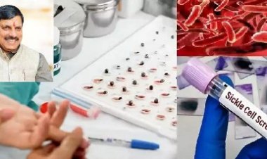 सिकल सेल मुक्त भारत अभियान में मध्यप्रदेश देश का अग्रणी राज्य